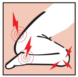 ProKnee no pad